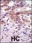 RSK4 Antibody (N-term)